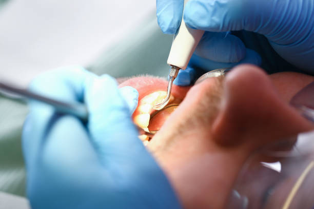 Best Emergency Tooth Extraction  in Combined Locks, WI