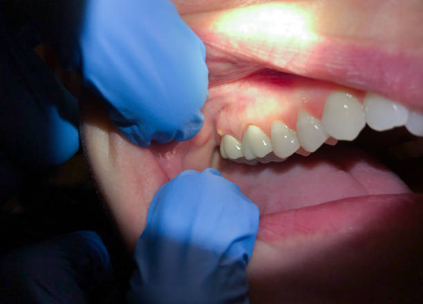 Dentist for Dental Trauma in WI