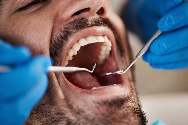 Best Teeth Whitening  in Combined Locks, WI